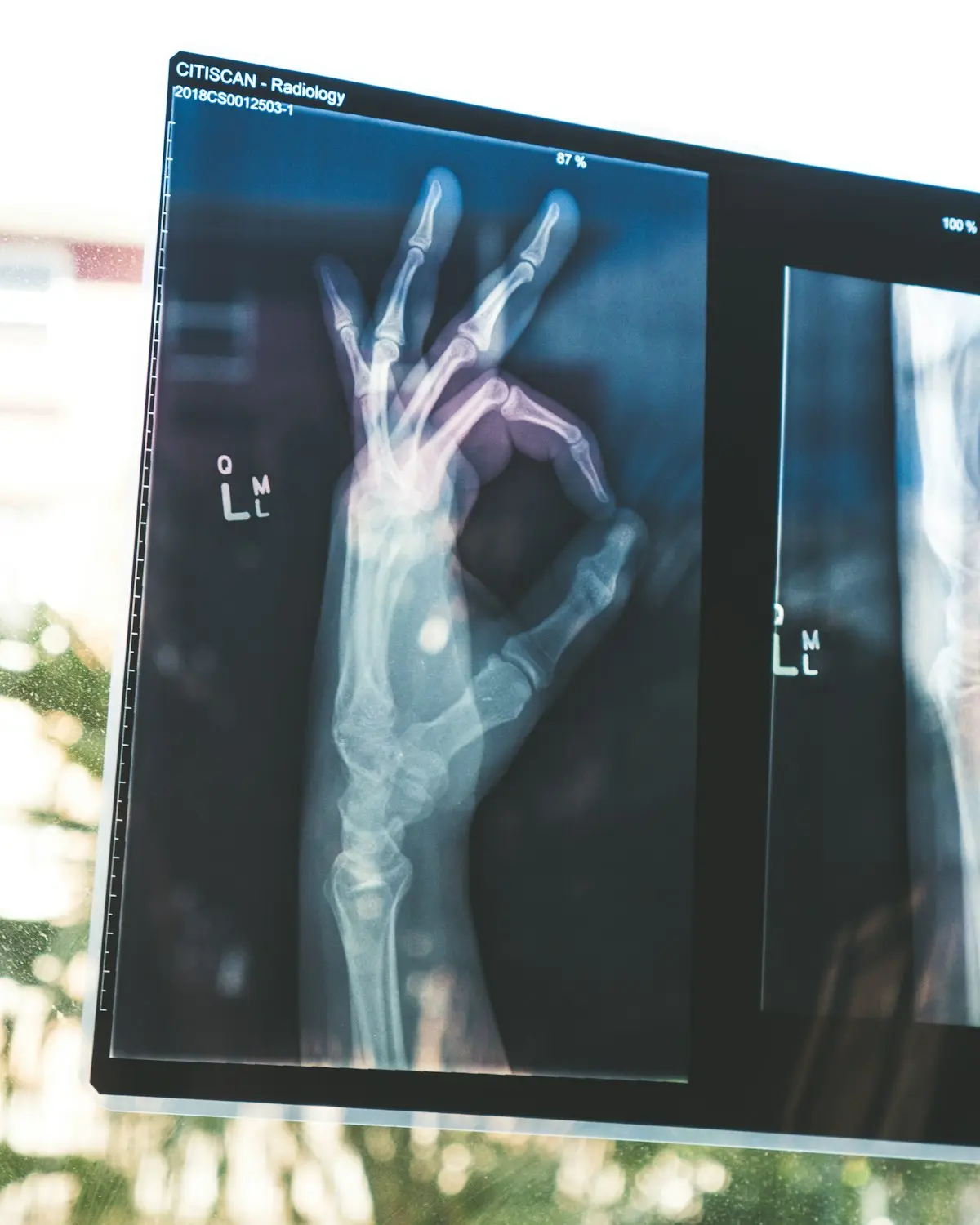 Profissional de saúde monitorando indicadores de pacientes crônicos em sistema digital